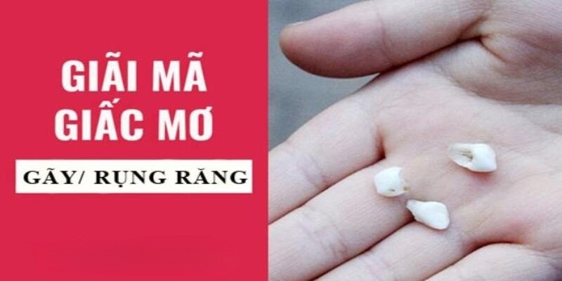 Luck8 - Ý Nghĩa Nằm Mơ Thấy Gãy Răng, Con Số Tài Lộc Đi Kèm